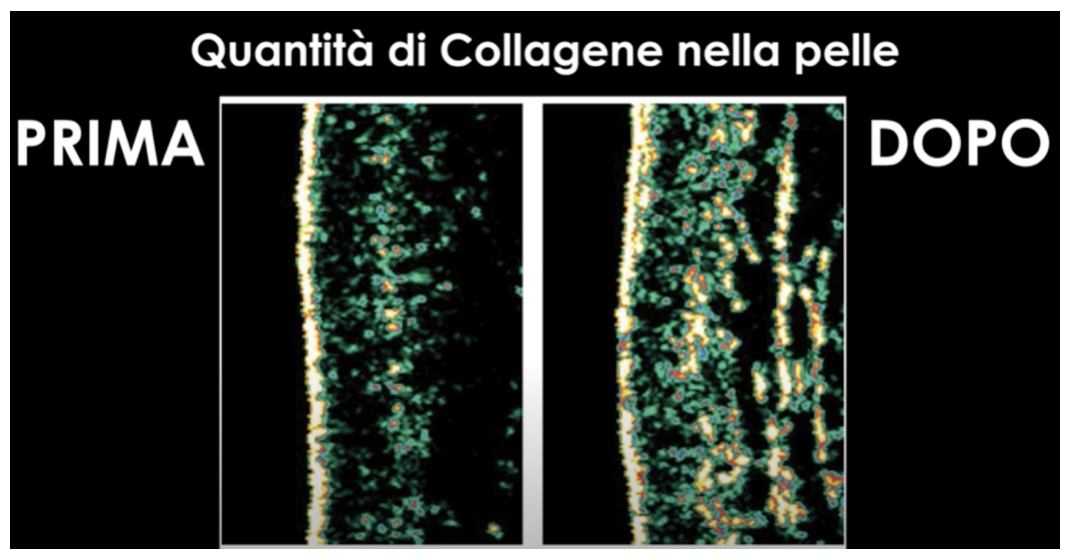 Vantaggi prima e dopo | Sanotech Vantaggi prima e dopo | Sanotech